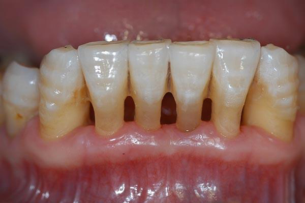 最新24小时牙医在线咨询方法分析(最方便真实的有没有24小时牙医方法)